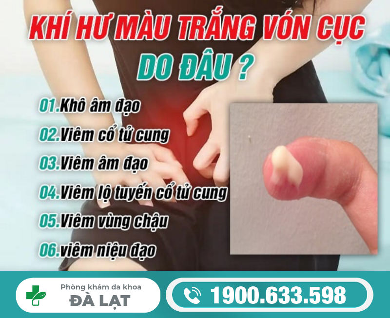 Hình ảnh minh họa